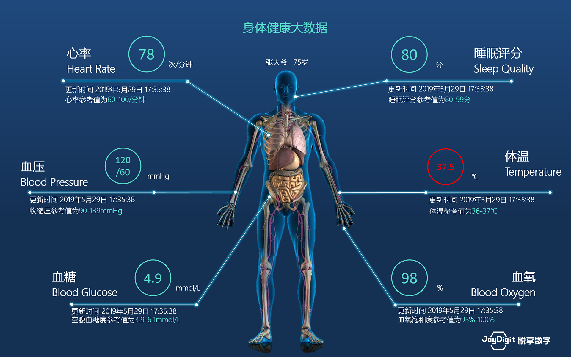 消费日报：悦享数字推动新兴技术与养老服务相结合，加快养老行业数字化转型(图9)
